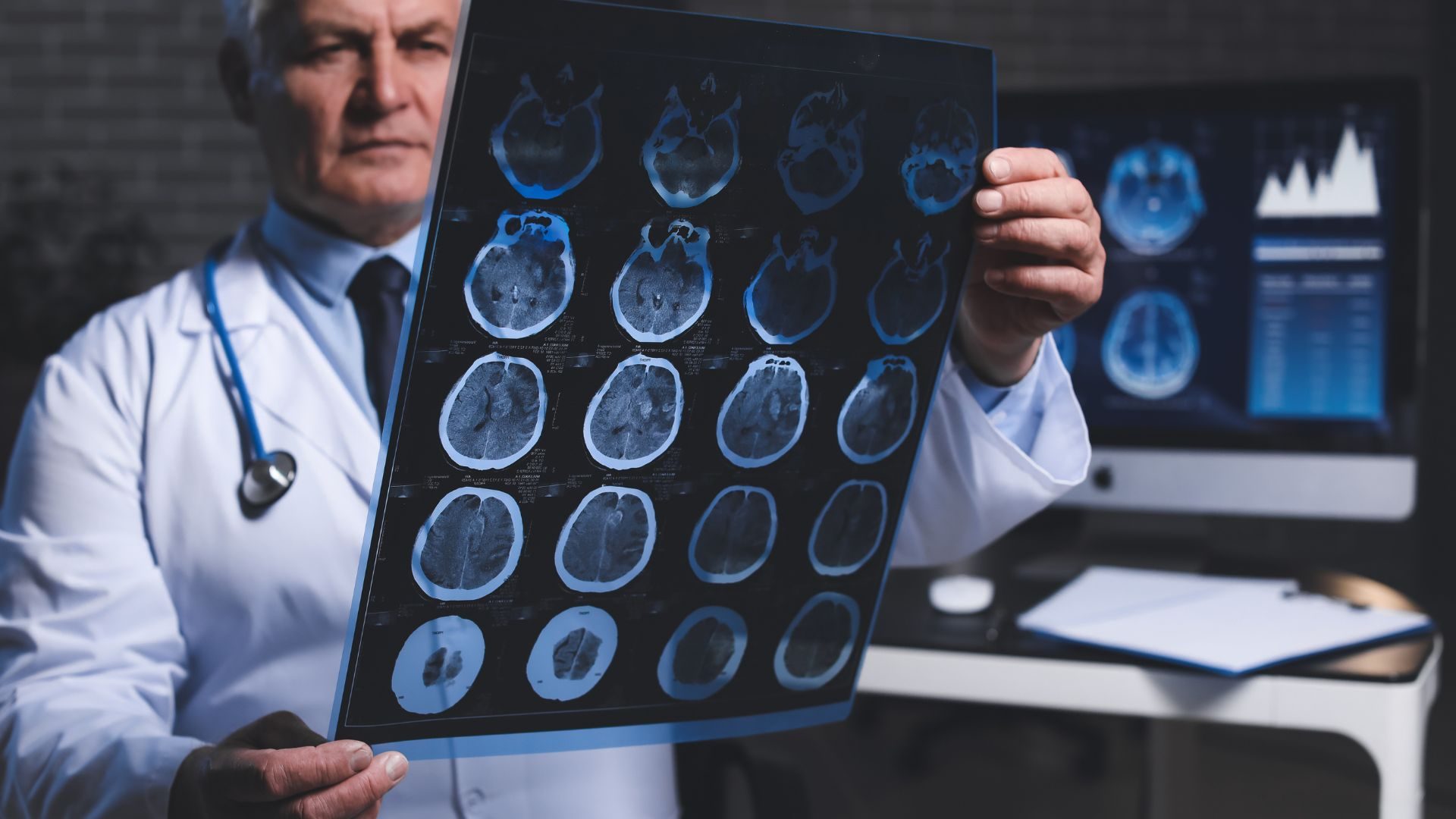 Seizure Activity and Episode Uncertainty