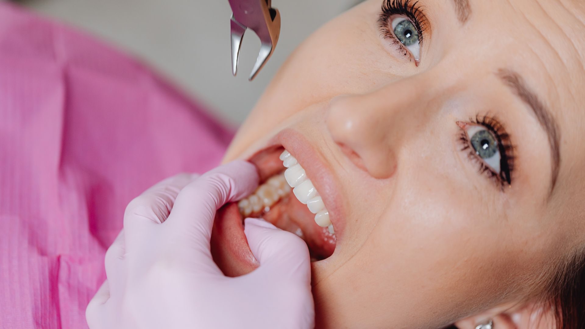Why Results and Safety Messaging Build Trust for Oral Surgery Cases
