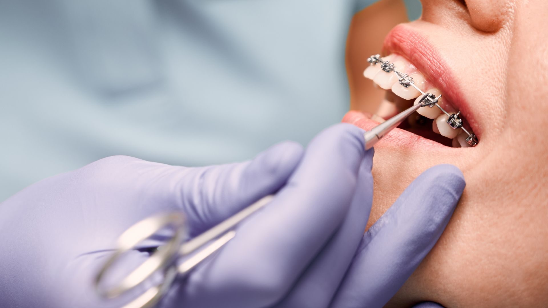 Orthodontist SEO Meets Patients at the Exact Moment They Decide to Fix Their Smile