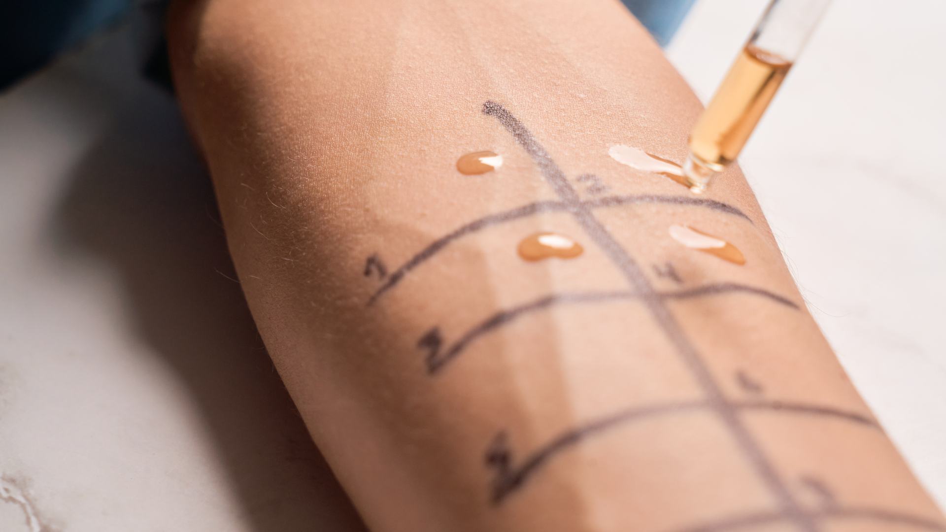 How Many Allergies Are Covered Under Allergy Testing?