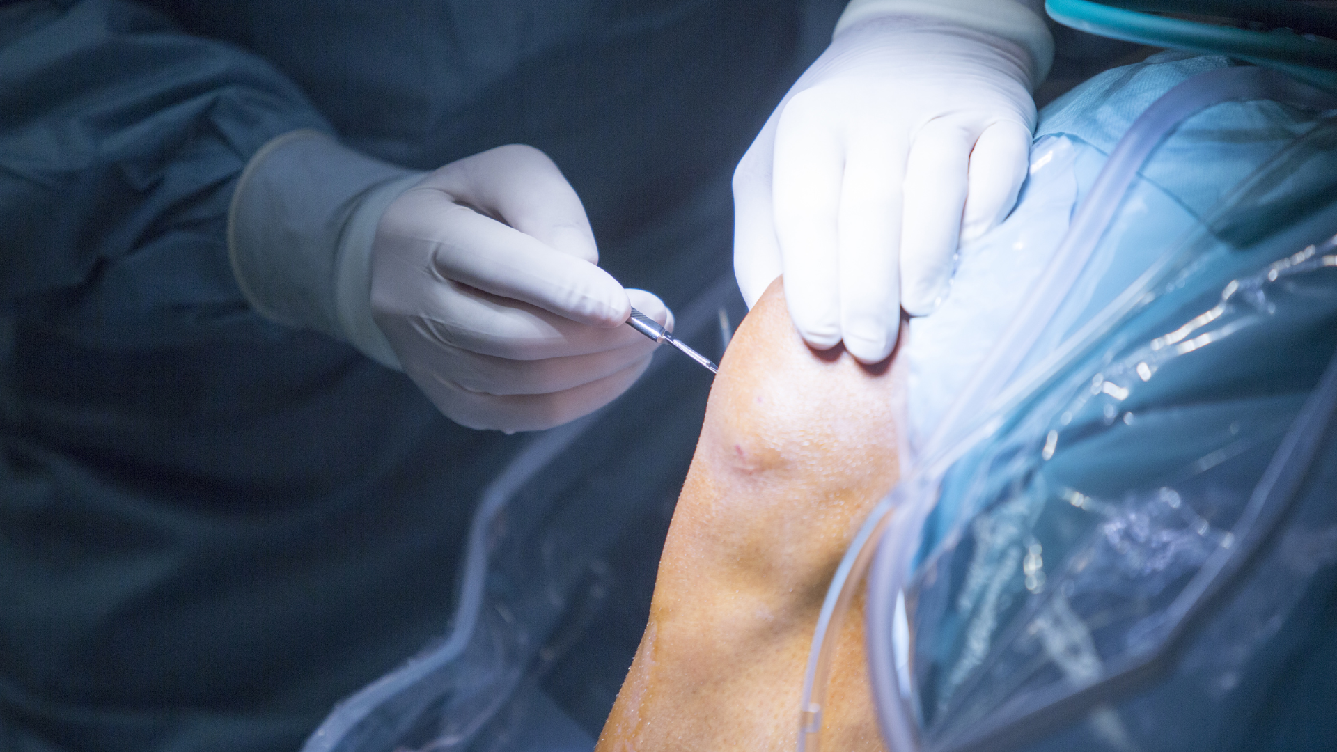 Tips for Creating AI-Optimized Orthopedic Surgery Content 